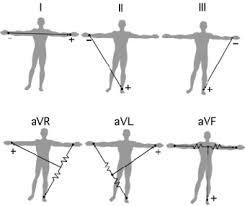 Diagram of ECG lead views