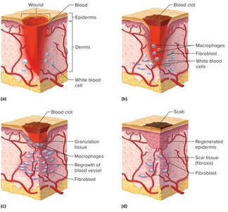 Stages of tissue repair in the skin