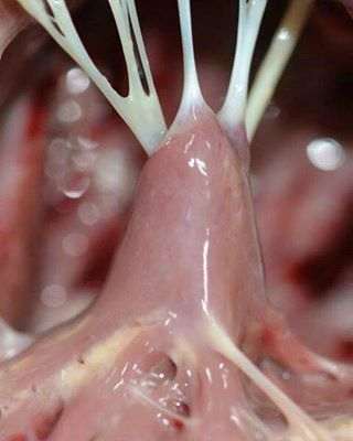 Papillary muscles and chordae tendineae