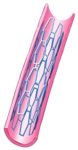 Coronary arteries and veins