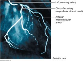 Coronary angiography