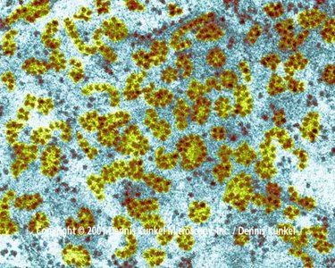 Electron micrograph of ribosomes