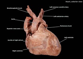 Labeled anatomical heart specimen