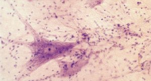 Nervous tissue of the brain