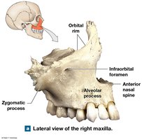 Lateral view of right maxilla