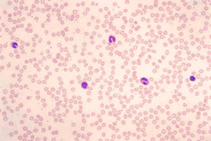 Blood smear showing erythrocytes and leukocytes