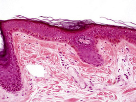 Stratified squamous epithelium under the microscope