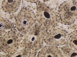 Microscopic view of bone tissue showing osteons