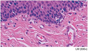 Epithelial tissue lining surfaces
