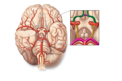 Circle of Willis, inferior view