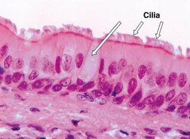 Photomicrograph of ciliated epithelial tissue