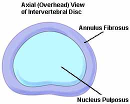 Axial view of an intervertebral disc showing annulus fibrosus and nucleus pulposus