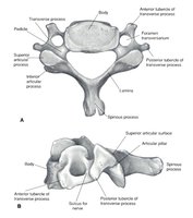 Cervical vertebra with labeled anatomical features