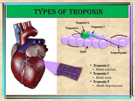 Types of troponin and their functions