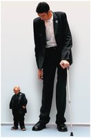 Disorders of pituitary growth hormone: gigantism and dwarfism