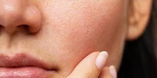 Apical and basal surfaces of epithelial tissue