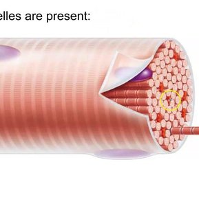 Muscle fiber showing myofibrils and sarcoplasmic reticulum
