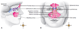Diagram of paranasal sinuses and nasal cavity