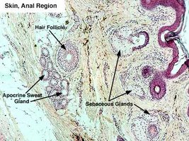 Histology of skin showing apocrine and sebaceous glands