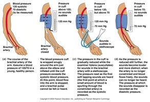 Measuring arterial blood pressure