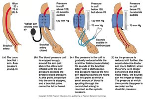 Measuring arterial blood pressure