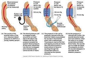 Measuring arterial blood pressure