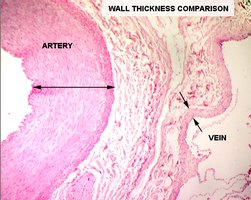 Wall thickness comparison between artery and vein