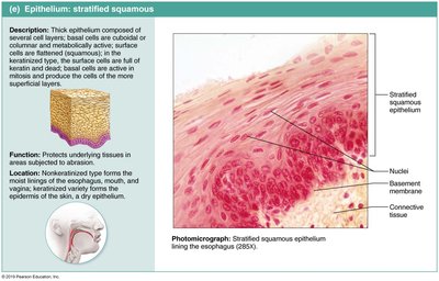 Diagram and photomicrograph of stratified squamous epithelium