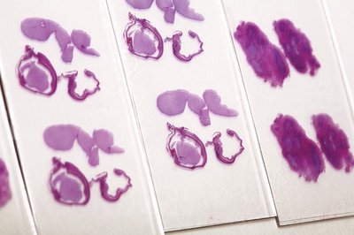 Microscope slides with stained tissue sections