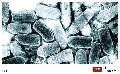 TEM of rabies virus