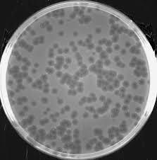 Viral plaques in cell culture