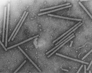 Electron micrograph of tobacco mosaic virus