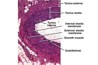 Histological section of an artery wall