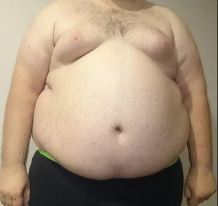 Obese adult