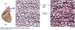 Dense regular elastic connective tissue