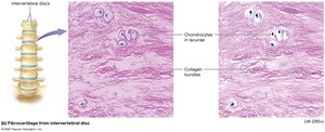 Fibrocartilage