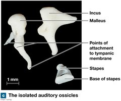 Isolated auditory ossicles