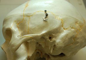Inferior view of the cranial base