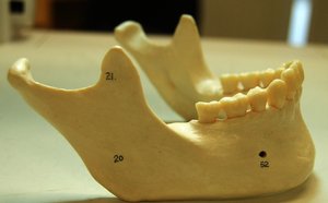 Lateral view of the mandible