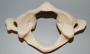 Atlas vertebra (C1), superior view