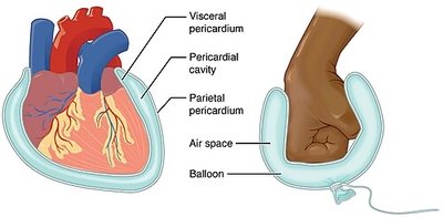 Pericardial membrane diagram