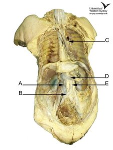 Cadaveric specimen with labeled structures