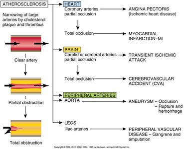 Oxygen supply and demand in angina