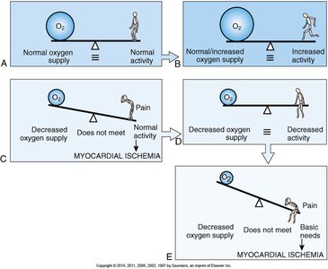 Serum enzyme changes after infarction