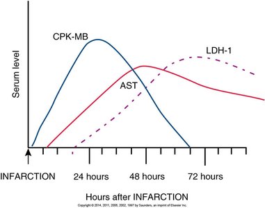 Post-myocardial infarction ECG changes