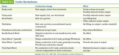 Table of cardiac dysrhythmias