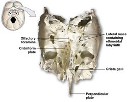 Ethmoid bone with labeled cribriform plate and crista galli