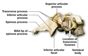 Typical cervical vertebra lateral view