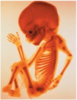 Fetal skeleton showing primary ossification centers