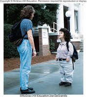 Comparison of normal and dwarfism stature